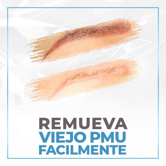 02- easily remove old pmu