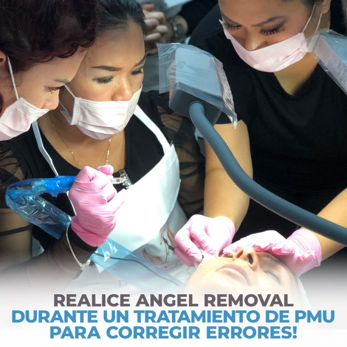 04 perform angel removal during a pmu treatment 04 perform angel removal during a pmu treatment